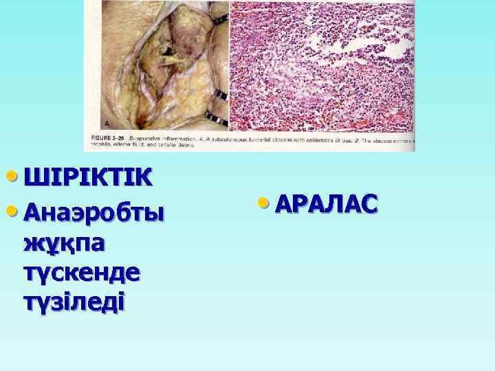  • ШІРІКТІК • Анаэробты жұқпа түскенде түзіледі • АРАЛАС 