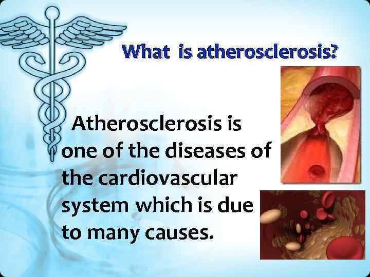 What is atherosclerosis? Atherosclerosis is one of the diseases of the cardiovascular system which