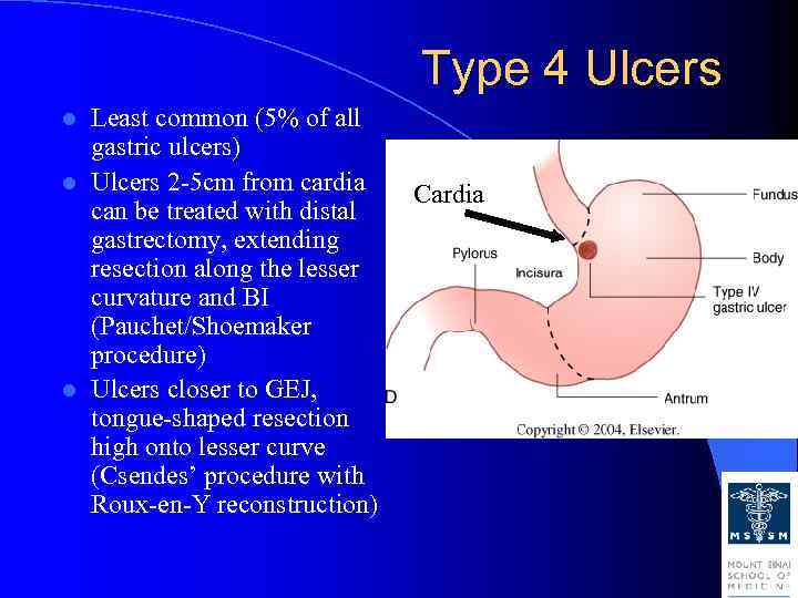 Gastric and duodenal ulcer disease Anatomy Arterial