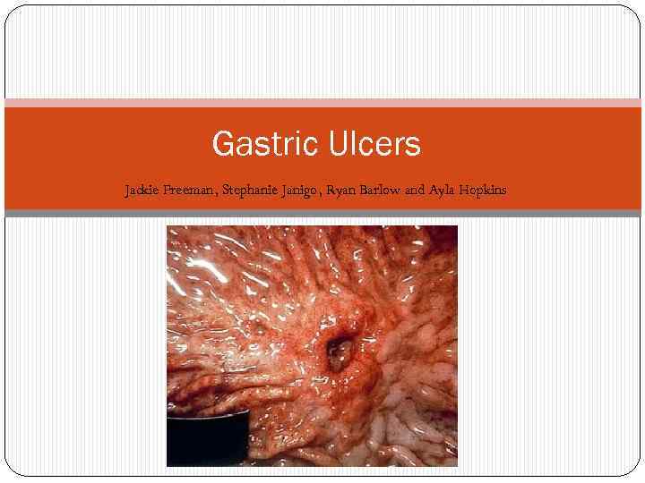 Gastric Ulcers Jackie Freeman, Stephanie Janigo, Ryan Barlow and Ayla Hopkins 