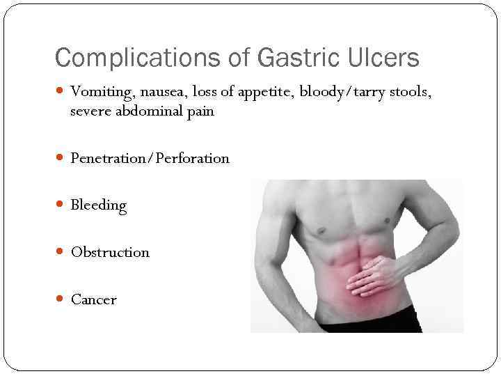 Complications of Gastric Ulcers Vomiting, nausea, loss of appetite, bloody/tarry stools, severe abdominal pain