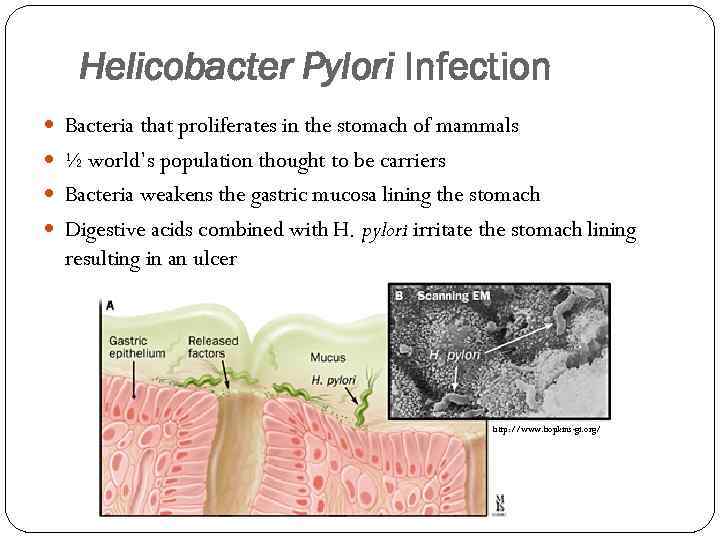 Helicobacter Pylori Infection Bacteria that proliferates in the stomach of mammals ½ world’s population