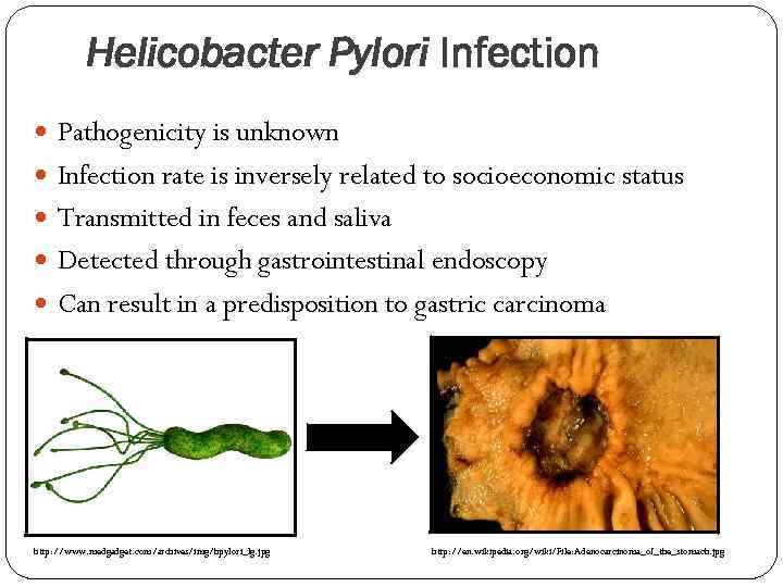 Helicobacter Pylori Infection Pathogenicity is unknown Infection rate is inversely related to socioeconomic status