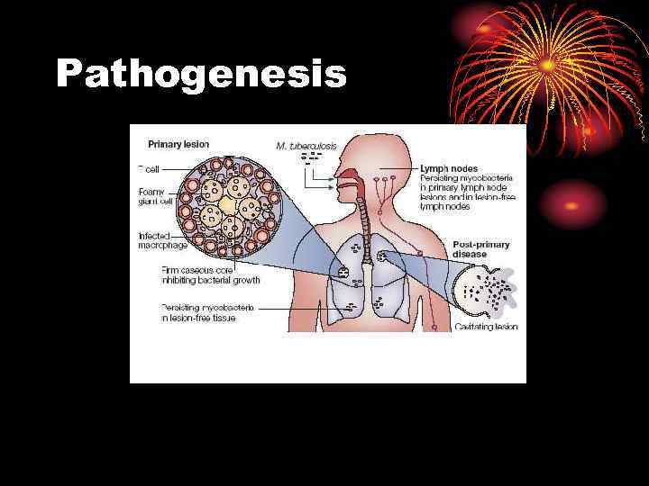 Pathogenesis 