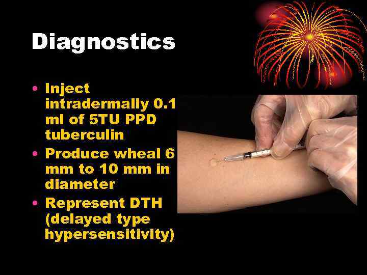 Diagnostics • Inject intradermally 0. 1 ml of 5 TU PPD tuberculin • Produce