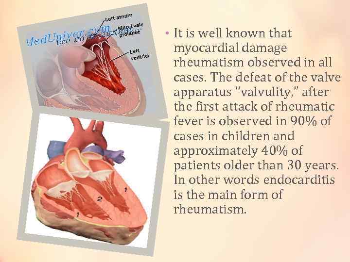  • It is well known that myocardial damage rheumatism observed in all cases.