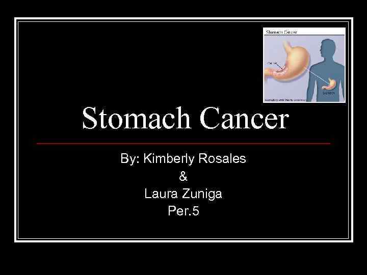 Stomach Cancer By: Kimberly Rosales & Laura Zuniga Per. 5 