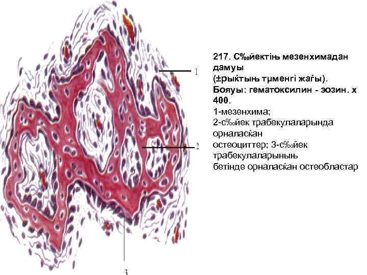 217. С‰йектіњ мезенхимадан дамуы (±рыќтыњ тμменгі жаѓы). Бояуы: гематоксилин - эозин. х 400. 1