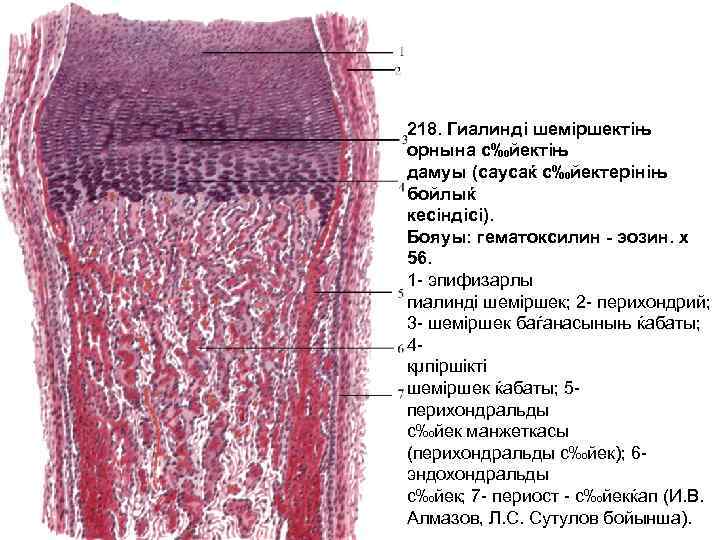 218. Гиалинді шеміршектіњ орнына с‰йектіњ дамуы (саусаќ c‰йектерiнiњ бойлыќ кесіндісі). Бояуы: гематоксилин - эозин.