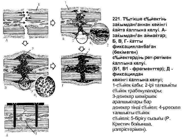 221. Т‰тікше с‰йектіњ заќымданѓаннан кейінгі ќайта ќалпына келуі. Азаќымданѓан аймаќтар; Б, В, Г- ќатты