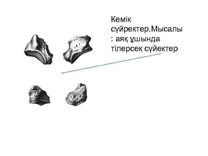 Кемік сүйректер. Мысалы : аяқ ұшында тілерсек сүйектер 