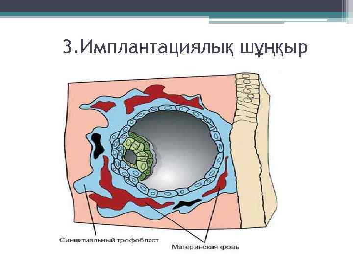 3. Имплантациялық шұңқыр 