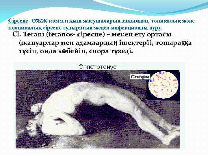 Сіреспе- ОЖЖ қозғалтқыш жасушаларын зақымдап, тоникалық және клоникалық сіреспе тудыратын жедел инфекционды ауру. Cl.