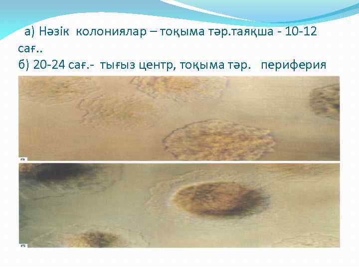 а) Нәзік колониялар – тоқыма тәр. таяқша - 10 -12 сағ. . б) 20