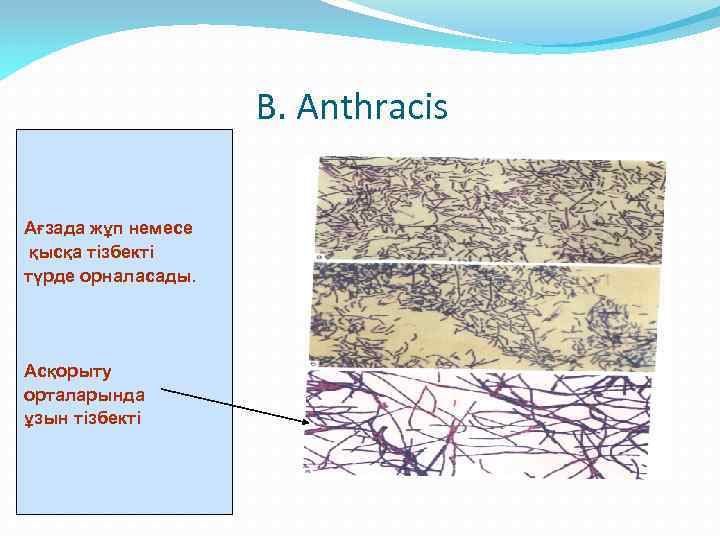В. Аnthracis Ағзада жұп немесе қысқа тізбекті түрде орналасады. Асқорыту орталарында ұзын тізбекті 