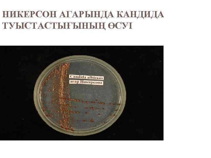 НИКЕРСОН АГАРЫНДА КАНДИДА ТУЫСТАСТЫҒЫНЫҢ ӨСУІ 