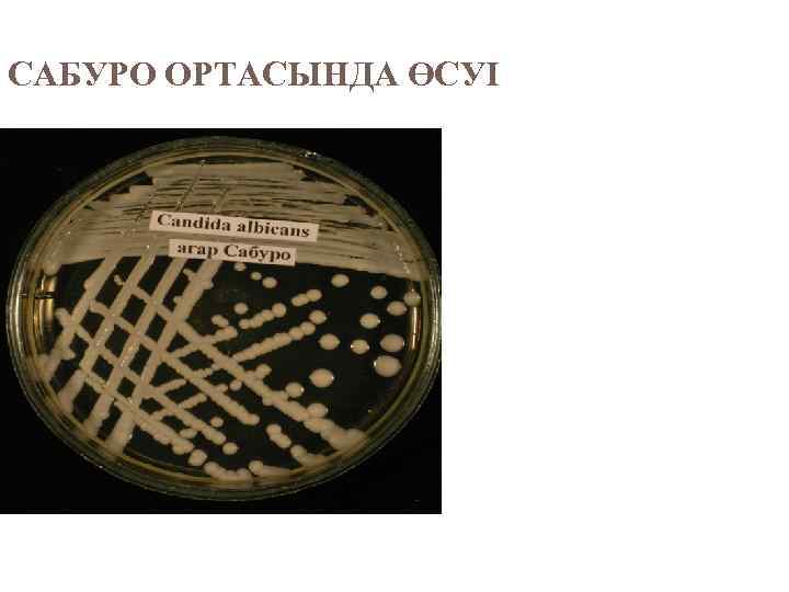 САБУРО ОРТАСЫНДА ӨСУІ 