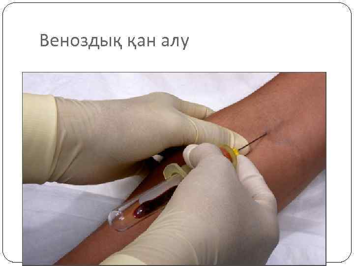 Веноздық қан алу 