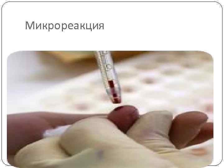 Микрореакция 