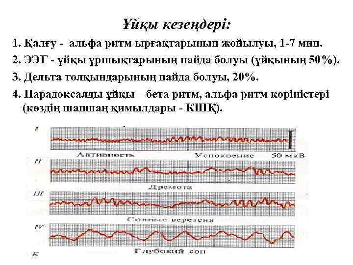 Ұйқы кезеңдері: 1. Қалғу - альфа ритм ырғақтарының жойылуы, 1 -7 мин. 2. ЭЭГ