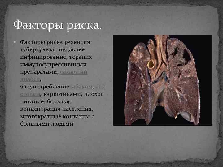 Факторы риска. Факторы риска развития туберкулеза : недавнее инфицирование, терапия иммуносупрессивными препаратами, сахарный диабет,