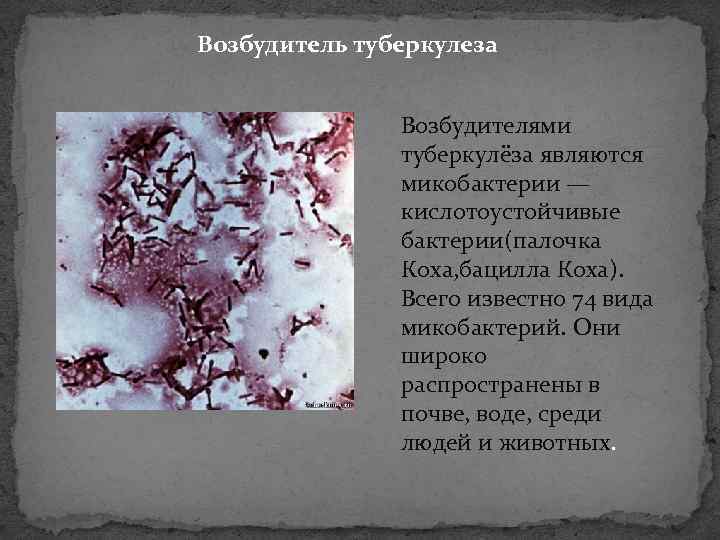 Возбудитель туберкулеза Возбудителями туберкулёза являются микобактерии — кислотоустойчивые бактерии(палочка Коха, бацилла Коха). Всего известно