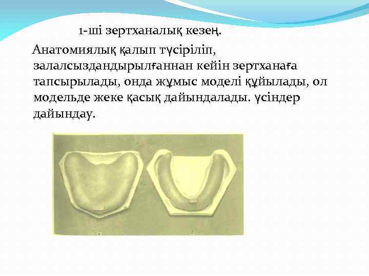 1 -ші зертханалық кезең. Анатомиялық қалып түсіріліп, залалсыздандырылғаннан кейін зертханаға тапсырылады, онда жұмыс моделі