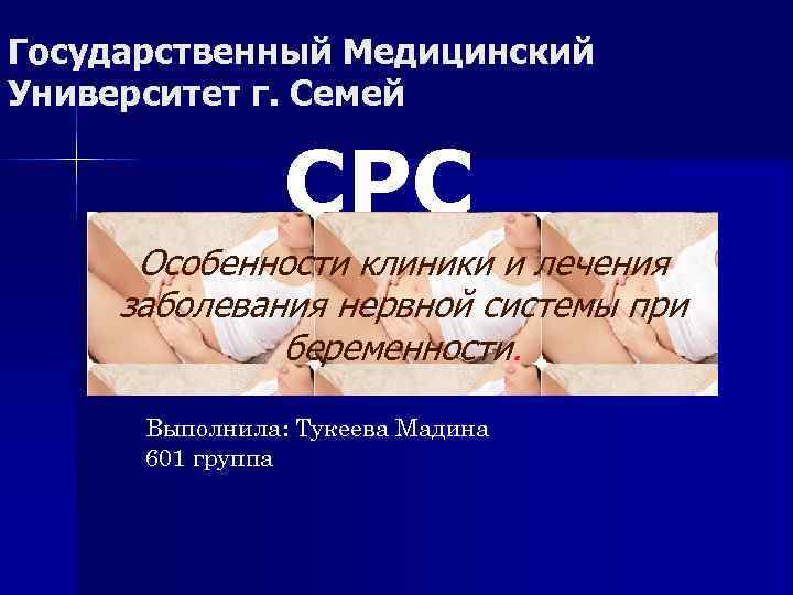 Государственный Медицинский Университет г. Семей СРС Особенности клиники и лечения заболевания нервной системы при