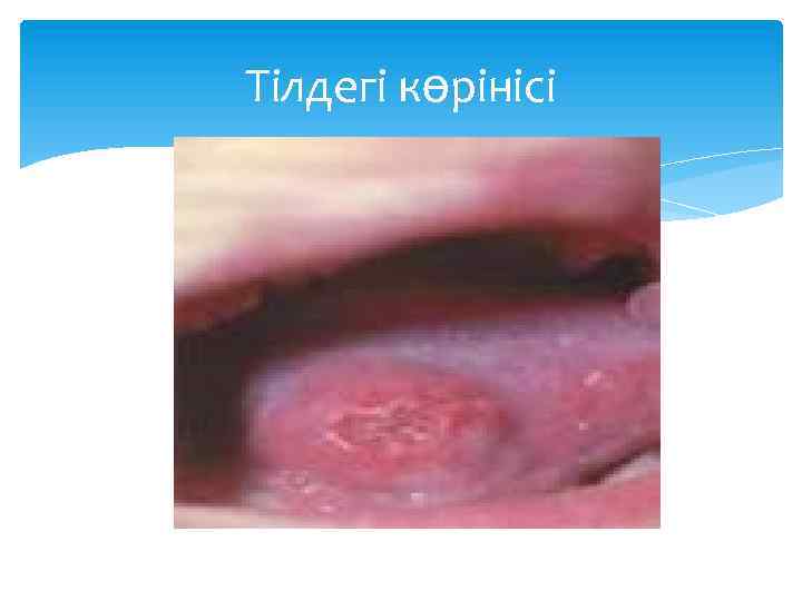 Тілдегі көрінісі 