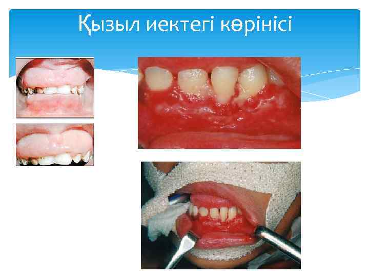 Қызыл иектегі көрінісі 