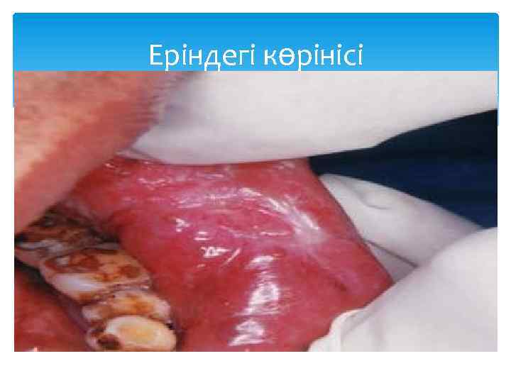 Еріндегі көрінісі 