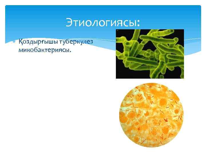 Этиологиясы: Қоздырғышы туберкулез микобактериясы. 