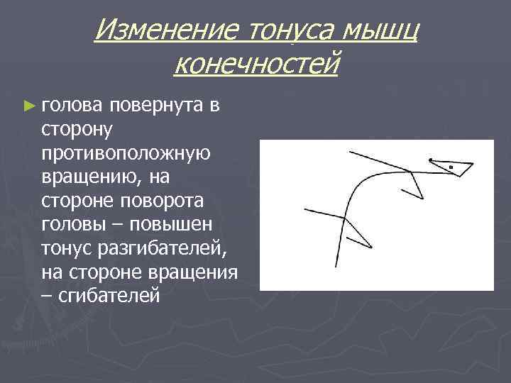 Изменение тонуса мышц конечностей ► голова повернута в сторону противоположную вращению, на стороне поворота