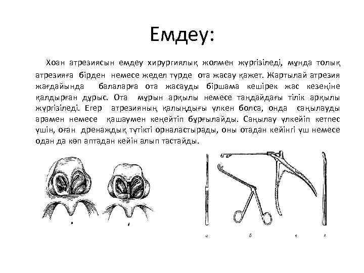 Емдеу: Хоан атрезиясын емдеу хирургиялық жолмен жүргізіледі, мұнда толық атрезияға бірден немесе жедел түрде
