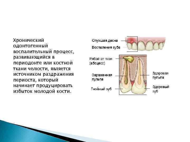 Фурункулы и карбункулы челюстно лицевой области презентация