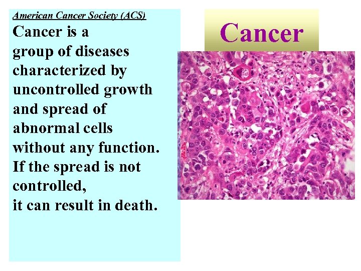American Cancer Society (ACS) Cancer is a group of diseases characterized by uncontrolled growth
