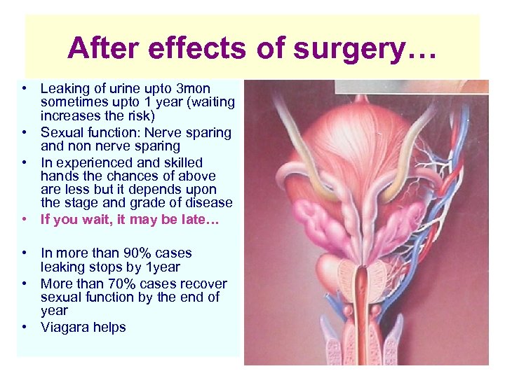 After effects of surgery… • Leaking of urine upto 3 mon sometimes upto 1