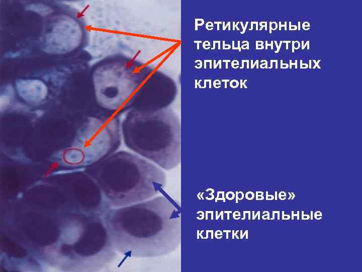 Ретикулярные вены фото