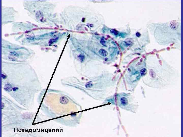 Псевдомицелий 