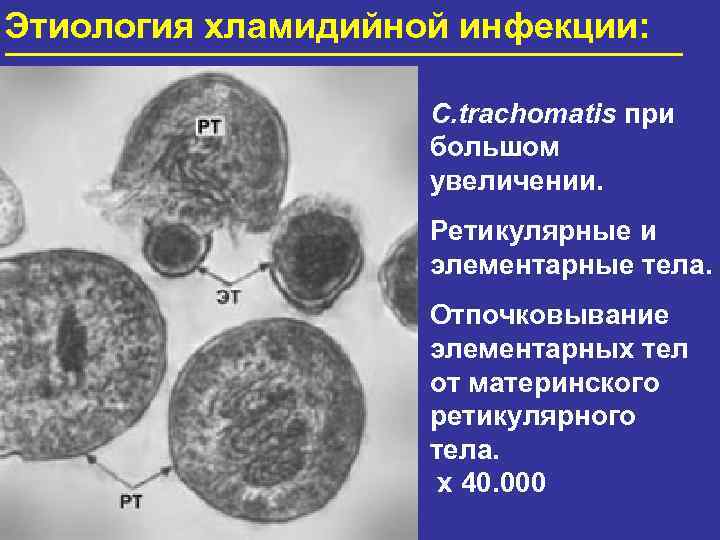 Хламидийная инфекция фото