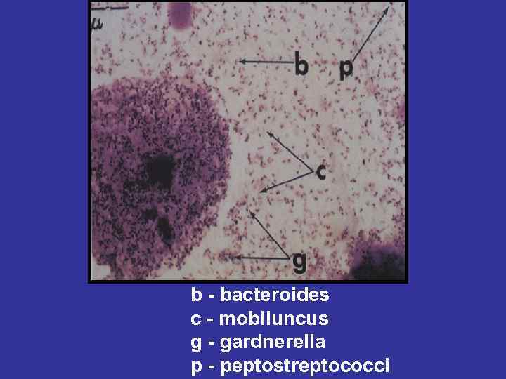 b - bacteroides c - mobiluncus g - gardnerella p - peptostreptococci 