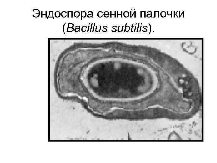 Эндоспора сенной палочки (Bacillus subtilis). 