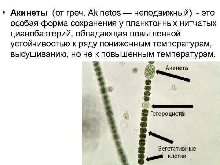 • Акинеты (от греч. Akinetos — неподвижный) - это особая форма сохранения у