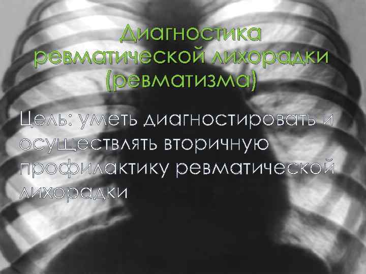 Диагностика ревматической лихорадки (ревматизма) Цель: уметь диагностировать и осуществлять вторичную профилактику ревматической лихорадки 