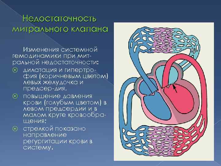 Недостаточность митрального клапана Изменения системной гемодинамики при митральной недостаточности: ⦿ дилатация и гипертрофия (коричневым