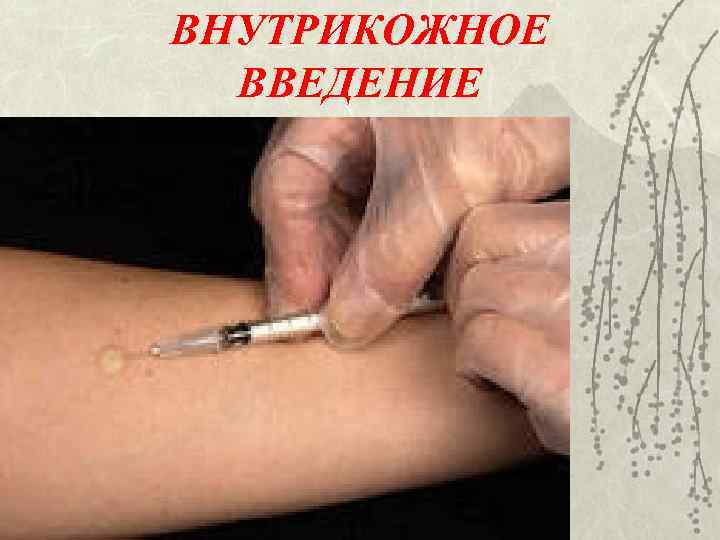 ВНУТРИКОЖНОЕ ВВЕДЕНИЕ 