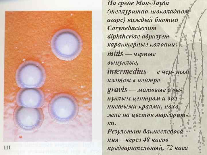 На среде Мак-Лауда (теллуритно-шоколадном агаре) каждый биотип Corynebacterium diphtheriae образует характерные колонии: mitis —