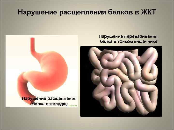 Нарушение расщепления белков в ЖКТ Нарушение переваривания белка в тонком кишечнике Нарушение расщепления белка