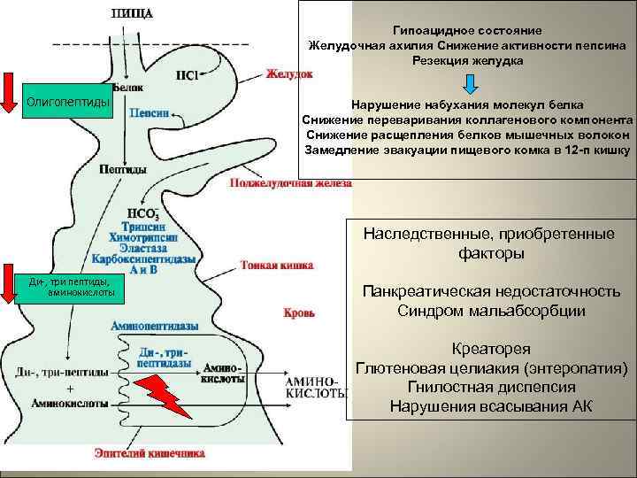 Гипоацидное состояние Желудочная ахилия Снижение активности пепсина Резекция желудка Олигопептиды Нарушение набухания молекул белка