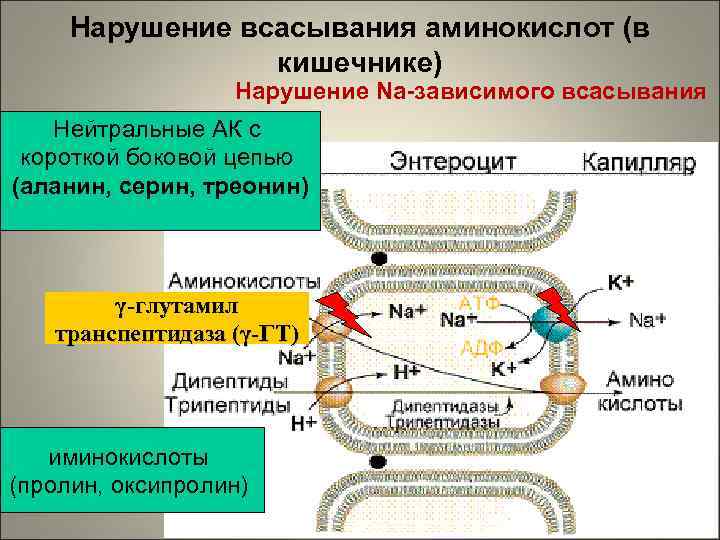 Нарушение всасывания аминокислот (в кишечнике) Нарушение Na-зависимого всасывания Нейтральные АК с короткой боковой цепью